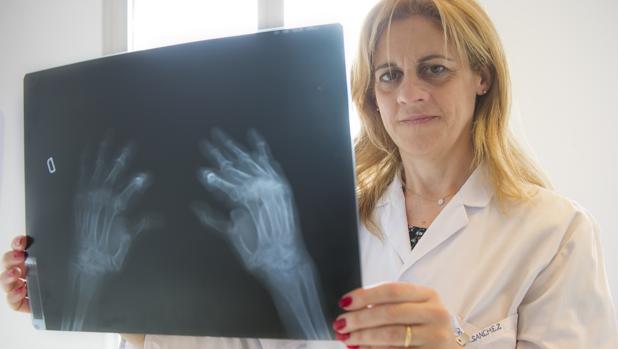 Una profesional mira los resultados de una radiografía de manos
