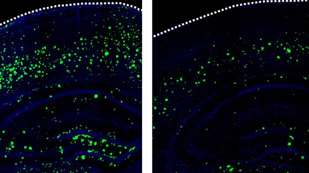 3K3A-APC (derecha) reduce en gran medida la cantidad de amiloide-β (verde) que se acumula en los cerebros de ratones que desarrollan síntomas similares al Alzheimer en comparación con ningún tratamiento (izquierda)