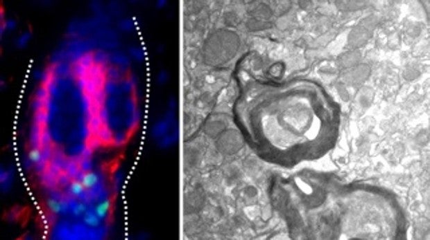 Células madre melanocíticas