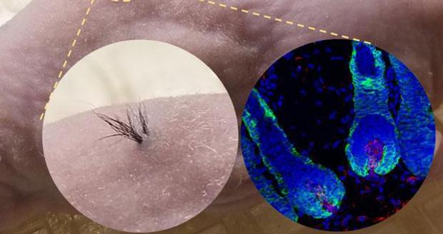 Izquierda: vista exterior ampliada. derecha: imagen de microscopía fluorescente de folículos pilosos debajo de la piel; núcleos celulares (azules), células epiteliales (verdes), células de la papila dérmica humana (rojas).
