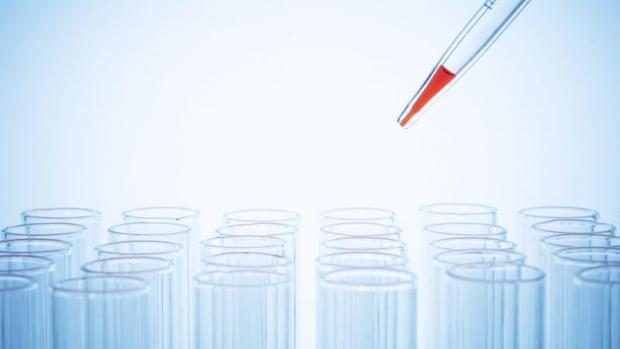La hepatitis C se diagnostica con una análisis de sangre