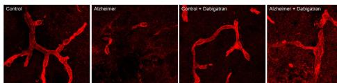 Los vasos cerebrales (rojo) están dañados en los ratones con alzhéimer, pero el tratamiento anticoagulante con dabigatrán previene dicho vaso vascular